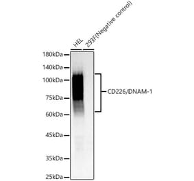 Western Blot - Anti-CD226 Antibody [ARC60137] (A309629) - Antibodies.com