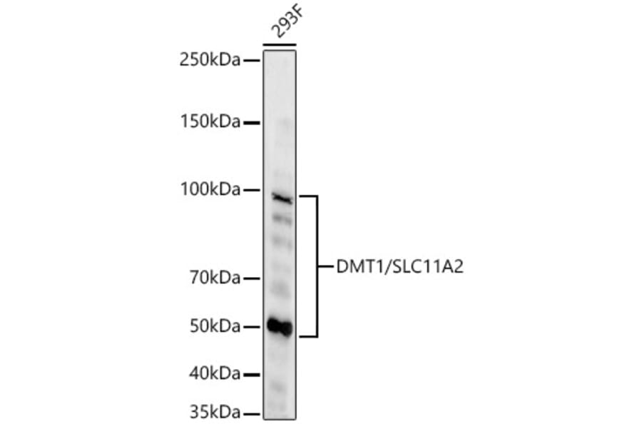 Western Blot - Anti-DMT1 Antibody [ARC59972] (A309631) - Antibodies.com