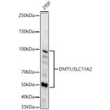 Western Blot - Anti-DMT1 Antibody [ARC59972] (A309631) - Antibodies.com
