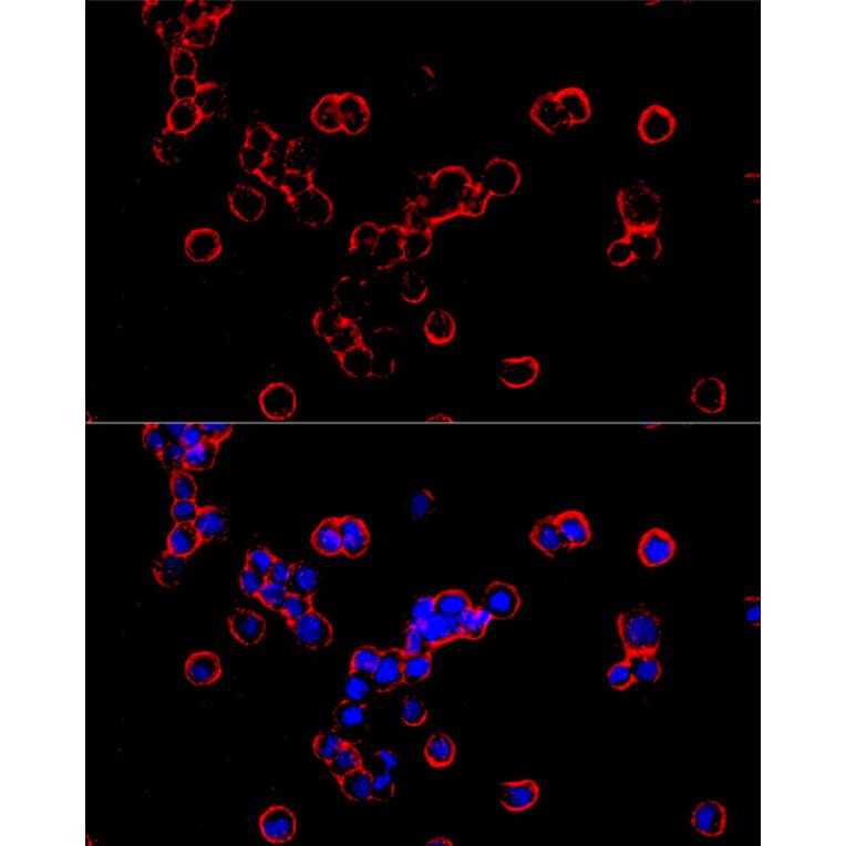 Immunofluorescence - Anti-DMT1 Antibody [ARC59972] (A309631) - Antibodies.com
