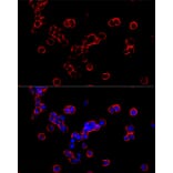 Immunofluorescence - Anti-DMT1 Antibody [ARC59972] (A309631) - Antibodies.com