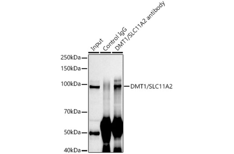 Western Blot - Anti-DMT1 Antibody [ARC59972] (A309631) - Antibodies.com