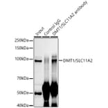 Western Blot - Anti-DMT1 Antibody [ARC59972] (A309631) - Antibodies.com