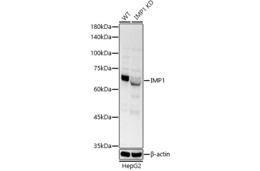 Western Blot - Anti-IGF2BP1/IMP1 Antibody (A309637) - Antibodies.com