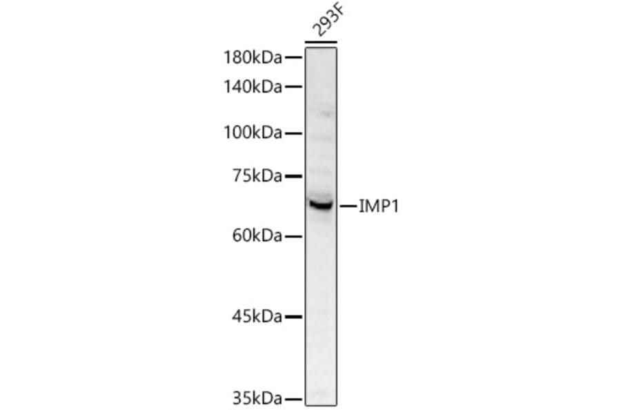 Western Blot - Anti-IGF2BP1/IMP1 Antibody (A309637) - Antibodies.com