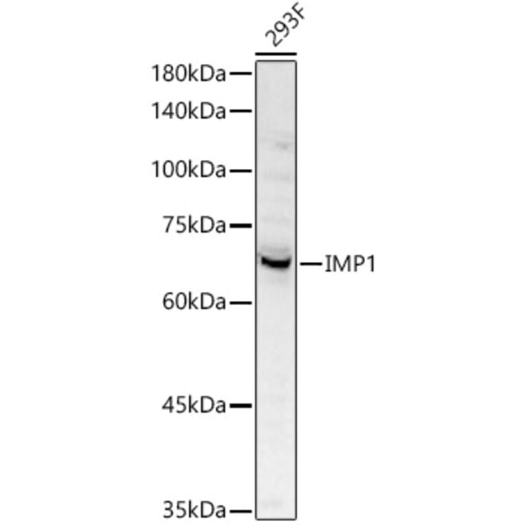Western Blot - Anti-IGF2BP1/IMP1 Antibody (A309637) - Antibodies.com