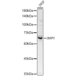 Western Blot - Anti-IGF2BP1/IMP1 Antibody (A309637) - Antibodies.com