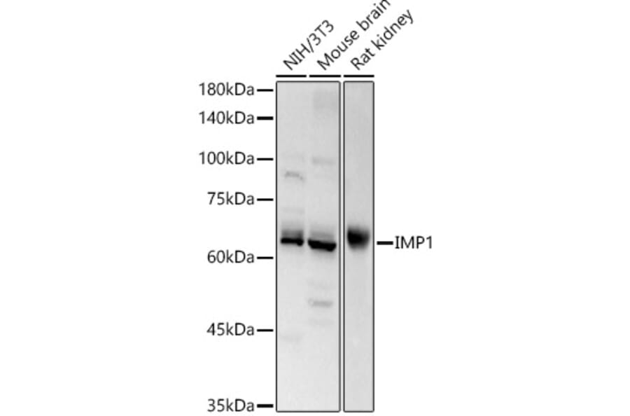Western Blot - Anti-IGF2BP1/IMP1 Antibody (A309637) - Antibodies.com
