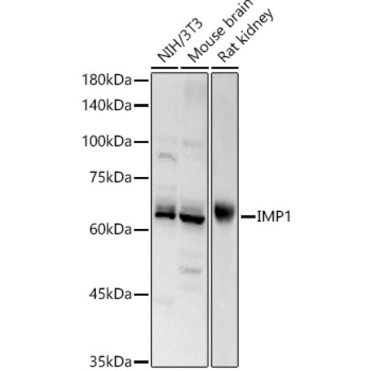 Western Blot - Anti-IGF2BP1/IMP1 Antibody (A309637) - Antibodies.com