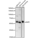 Western Blot - Anti-IGF2BP1/IMP1 Antibody (A309637) - Antibodies.com