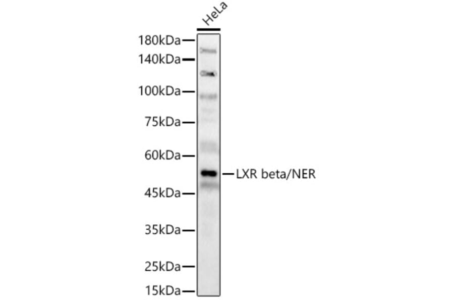 Western Blot - Anti-LXR beta/NER Antibody (A309639) - Antibodies.com