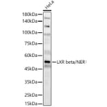 Western Blot - Anti-LXR beta/NER Antibody (A309639) - Antibodies.com