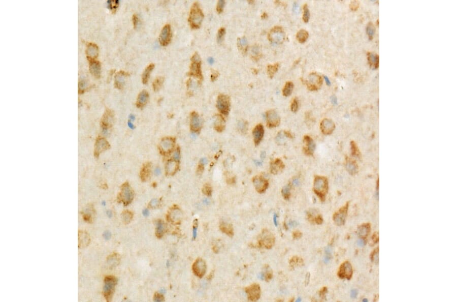 Immunohistochemistry - Anti-TSG101 Antibody [ARC57589] (A309646) - Antibodies.com