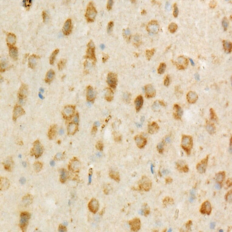 Immunohistochemistry - Anti-TSG101 Antibody [ARC57589] (A309646) - Antibodies.com