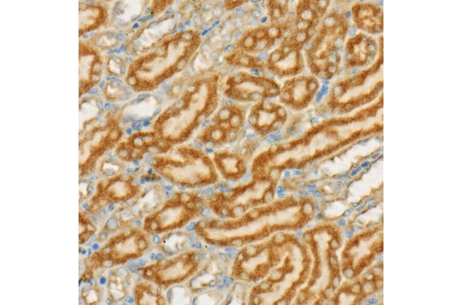Immunohistochemistry - Anti-TSG101 Antibody [ARC57589] (A309646) - Antibodies.com
