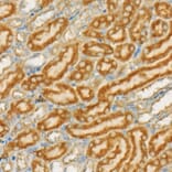 Immunohistochemistry - Anti-TSG101 Antibody [ARC57589] (A309646) - Antibodies.com