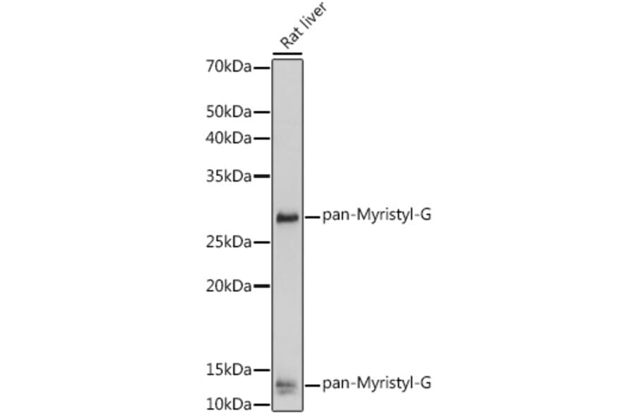Western Blot - Anti-pan myristoyl Glycine Antibody (A309647) - Antibodies.com