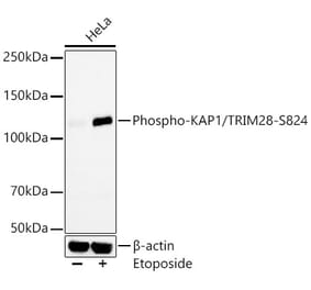 Western Blot - Anti-KAP1 (phospho Ser824) Antibody [ARC59356] (A309649) - Antibodies.com