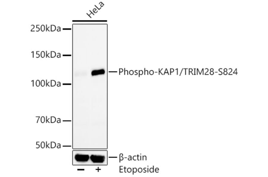 Western Blot - Anti-KAP1 (phospho Ser824) Antibody [ARC59356] (A309649) - Antibodies.com