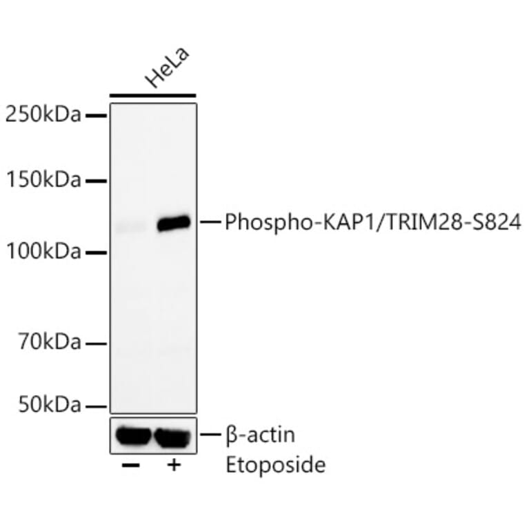 Western Blot - Anti-KAP1 (phospho Ser824) Antibody [ARC59356] (A309649) - Antibodies.com