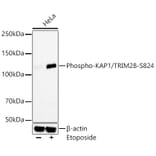Western Blot - Anti-KAP1 (phospho Ser824) Antibody [ARC59356] (A309649) - Antibodies.com
