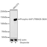 Western Blot - Anti-KAP1 (phospho Ser824) Antibody [ARC59356] (A309649) - Antibodies.com