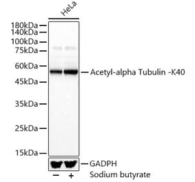 Western Blot - Anti-Detyrosinated alpha Tubulin (acetyl Lys40) Antibody (A309651) - Antibodies.com