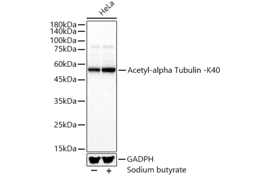 Western Blot - Anti-Detyrosinated alpha Tubulin (acetyl Lys40) Antibody (A309651) - Antibodies.com