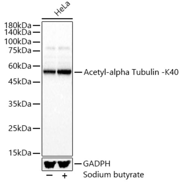 Western Blot - Anti-Detyrosinated alpha Tubulin (acetyl Lys40) Antibody (A309651) - Antibodies.com