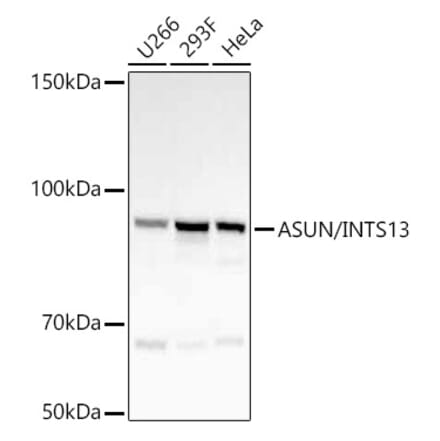Western Blot - Anti-INTS13 Antibody [ARC55758] (A309652) - Antibodies.com