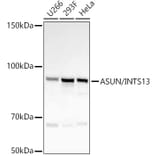 Western Blot - Anti-INTS13 Antibody [ARC55758] (A309652) - Antibodies.com
