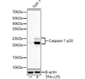 Western Blot - Anti-Caspase-1 Antibody [ARC60705] (A309653) - Antibodies.com