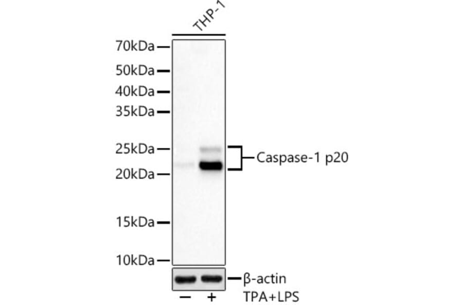 Western Blot - Anti-Caspase-1 Antibody [ARC60705] (A309653) - Antibodies.com