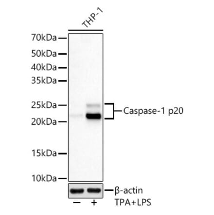Western Blot - Anti-Caspase-1 Antibody [ARC60705] (A309653) - Antibodies.com