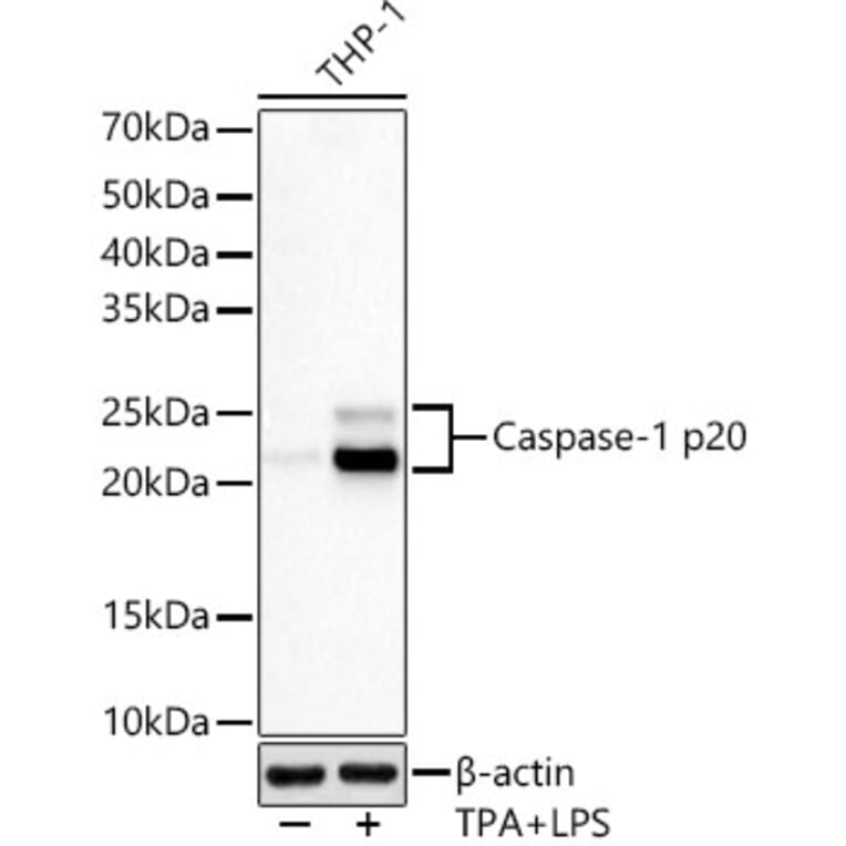 Western Blot - Anti-Caspase-1 Antibody [ARC60705] (A309653) - Antibodies.com