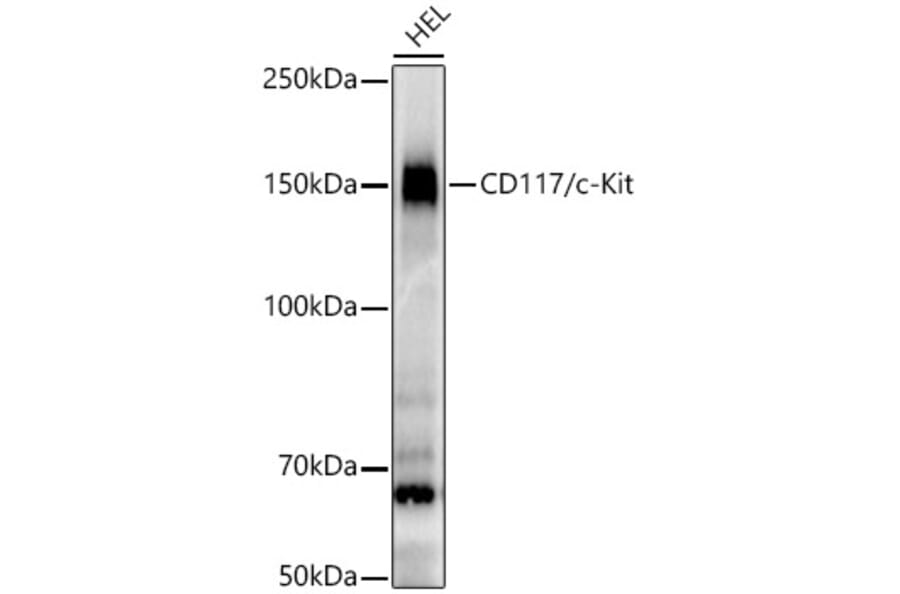 Western Blot - Anti-c-Kit Antibody [ARC56007] (A309654) - Antibodies.com