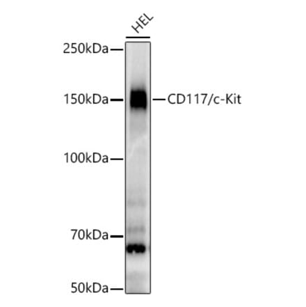 Western Blot - Anti-c-Kit Antibody [ARC56007] (A309654) - Antibodies.com