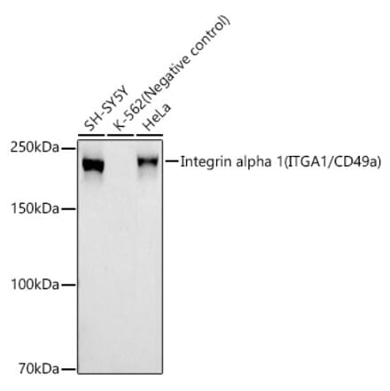 Western Blot - Anti-Integrin alpha 1 Antibody [ARC58198] (A309657) - Antibodies.com