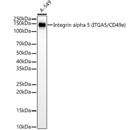 Western Blot - Anti-Integrin alpha 5 Antibody [ARC58291] (A309658) - Antibodies.com