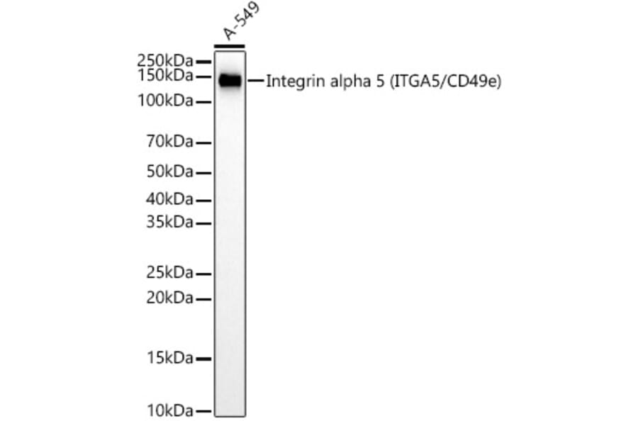 Western Blot - Anti-Integrin alpha 5 Antibody [ARC58291] (A309658) - Antibodies.com