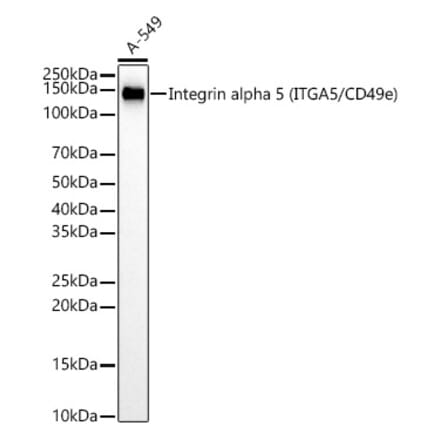 Western Blot - Anti-Integrin alpha 5 Antibody [ARC58291] (A309658) - Antibodies.com