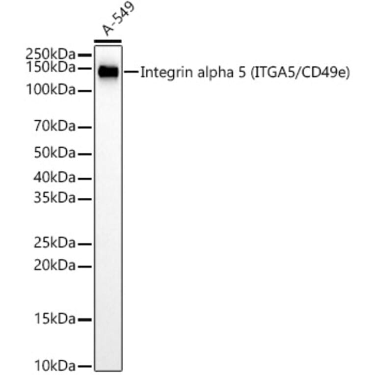 Western Blot - Anti-Integrin alpha 5 Antibody [ARC58291] (A309658) - Antibodies.com