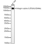 Western Blot - Anti-Integrin alpha 5 Antibody [ARC58291] (A309658) - Antibodies.com