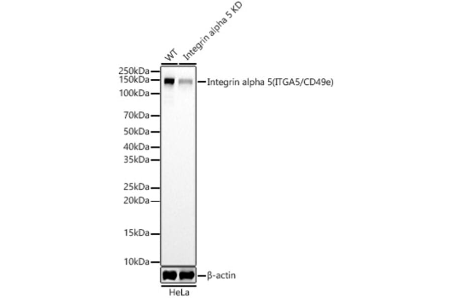 Western Blot - Anti-Integrin alpha 5 Antibody [ARC58291] (A309658) - Antibodies.com