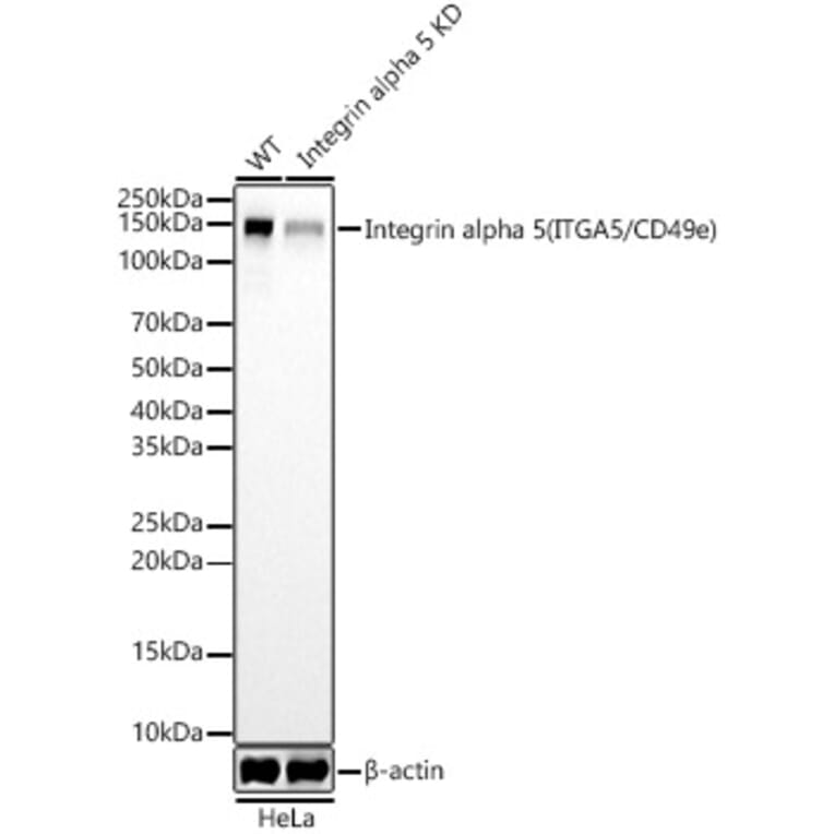 Western Blot - Anti-Integrin alpha 5 Antibody [ARC58291] (A309658) - Antibodies.com