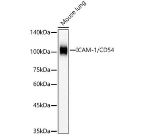 Western Blot - Anti-ICAM1 Antibody [ARC53633 + ARC54995] (A309666) - Antibodies.com