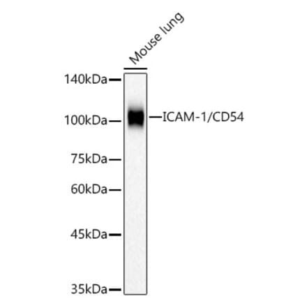 Western Blot - Anti-ICAM1 Antibody [ARC53633 + ARC54995] (A309666) - Antibodies.com