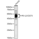 Western Blot - Anti-PD-L2 Antibody [ARC60190] (A309669) - Antibodies.com
