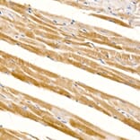 Immunohistochemistry - Anti-PD-L2 Antibody [ARC60190] (A309669) - Antibodies.com