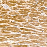 Immunohistochemistry - Anti-PD-L2 Antibody [ARC60190] (A309669) - Antibodies.com